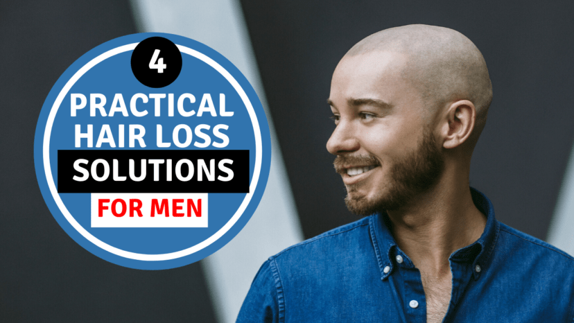 4 practical hair loss solutions for men