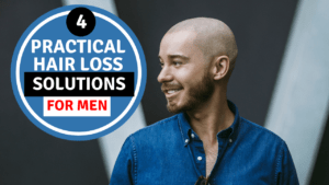 4 practical hair loss solutions for men