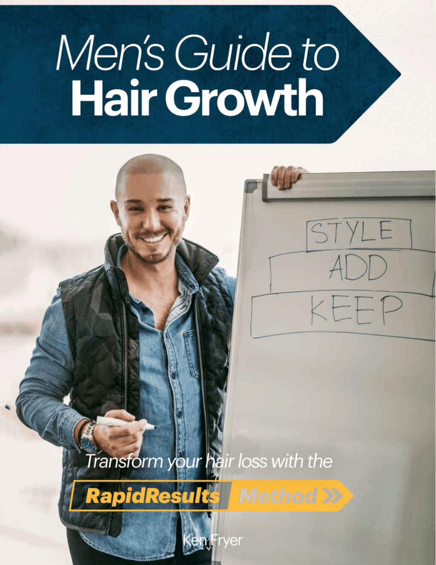 hair loss solutions for men