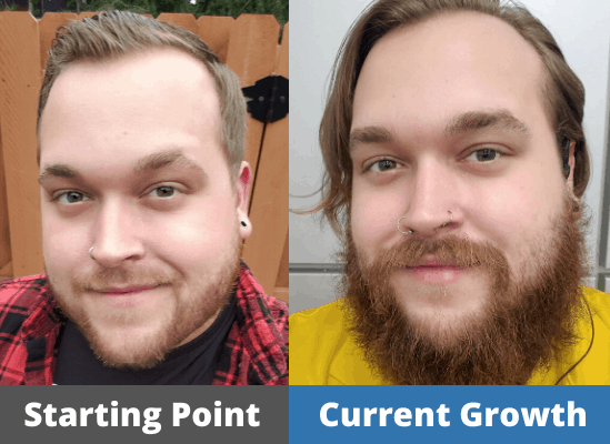 Chris's Hair growth Journey