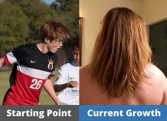 Ethan's Hair growth Journey