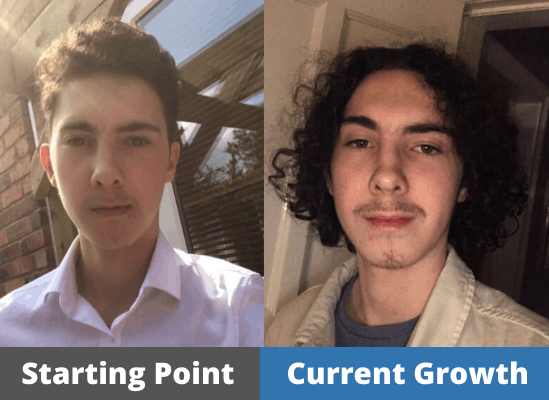 James' Hair growth Journey