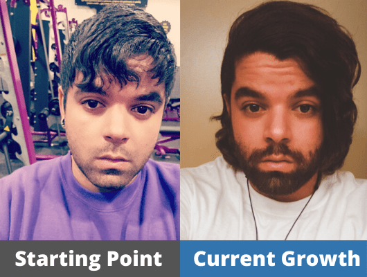 Jared's Hair growth Journey