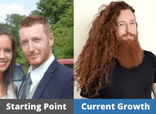 Owen's Hair growth Journey