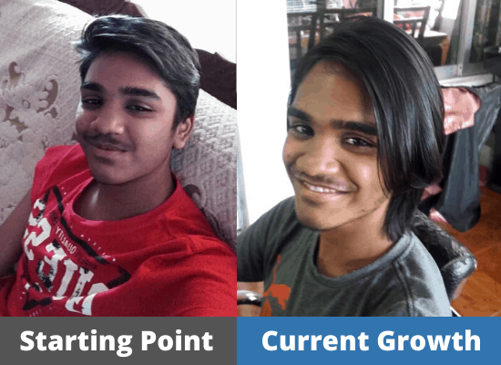 Sahil's Hair growth Journey