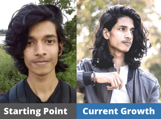 Saptarshi's hair growth journey