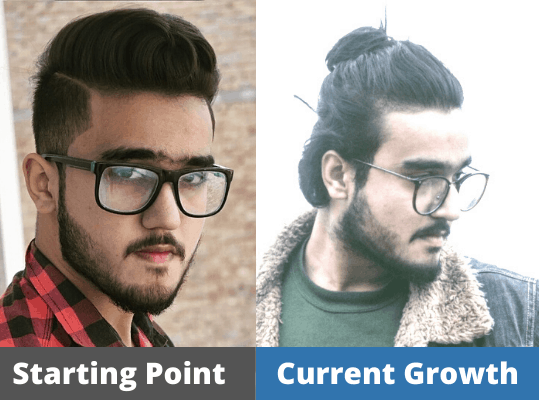 Wahab's Hair growth Journey
