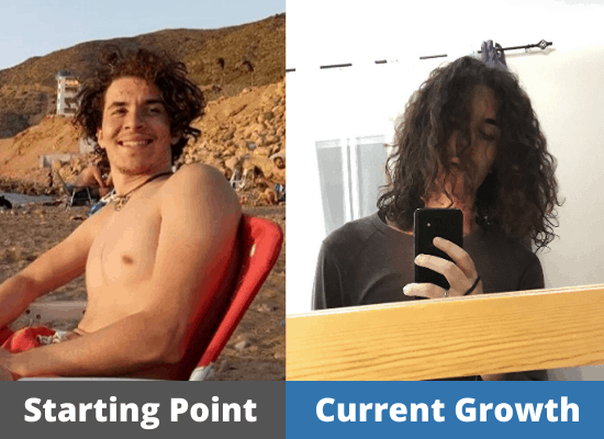 You's hair growth journey