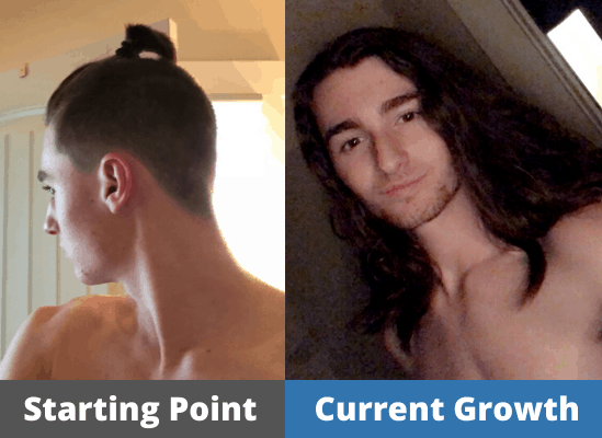 Hair Growth Journey Before & Afters from Our Members